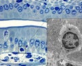 Intestinal epithelium. Lymphocytes