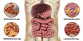 Intestinal microbiome, bacteria colonizing different parts of digestive system