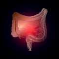 Intestine with a point of pain. Stylized transition from a real organ to an X-ray effect. Medical illustration of