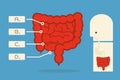 Intestines infographics