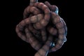 Intestines tangled in a knot