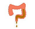 Intestines on a white background. Diarrhea. Vector