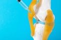 Intra-articular injection of anti-inflammatory medication into a mock-up knee joint on a blue background. The concept of