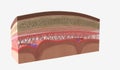 Intracranial Pressure and Cerebrospinal Fluid