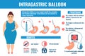 Intragastric balloon weight loss procedure medical infographic