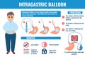 Intragastric balloon weight loss procedure medical infographic