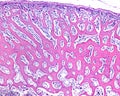 Intramembranous ossification. Woven bone