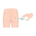 Intramuscular injection into the buttock with a syringe. Medicine single icon in cartoon style vector symbol stock