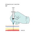 Intramuscular injection. Effective methods of administration of drugs and other medical solutions that are used for humans.