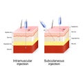 Intramuscular injection and Subcutaneous injection