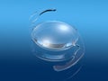 Intraocular lens IOL on blue background, medically 3D illustration