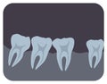 Intraoral radiograph of human teeth and gingiva. Dental x-ray picture or radiographic monitor image, side view. Medical