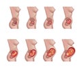 Fetal growth, ntrauterine development of the human embryo