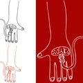 Intravenous Therapy Hand