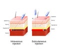 Intravenous therapy and Subcutaneous injection.