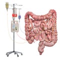 Intravenous therapy system with human intestines. Treatment and medicines for intestines disease concept, 3D rendering