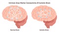 Intrinsic gray-matter connectivity of autistic brain. Neurodevelopmental