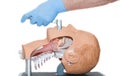 Intubation of an unconscious patient