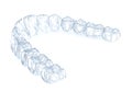 Invisalign braces or invisible retainer. Medically accurate dental 3D illustration