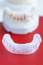 Invisalign, invisible plastic teeth aligner