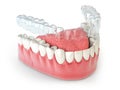 Invisalign invisible retainer or braces with lawer jaw islated on white Royalty Free Stock Photo