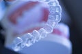 Invisible dental teeth aligners Royalty Free Stock Photo