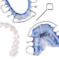 Invisible retainer and different braces Royalty Free Stock Photo