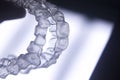 Invisible teeth aligners braces Royalty Free Stock Photo