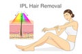 IPL light for hair removal on skin layer and beauty woman touching her skin.