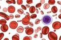 Iron deficiency anemia Royalty Free Stock Photo