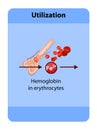 iron distribution in the body, iron deposition, utilization, bone marrow, red blood cells, blood dye, macrophages, iron deposition Royalty Free Stock Photo