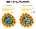 Islets of Langerhans Royalty Free Stock Photo