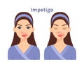 Isolated Cute cartoon Brunette woman with impetigo. Beautiful Face. Skin problems. Royalty Free Stock Photo