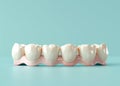 Isolated 3D illustration of a dental crown installed on teeth on a white background. Royalty Free Stock Photo