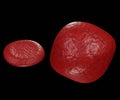 Isolated swollen erythrocyte with normal red blood cell