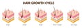 Isometric hair follicle growth cycle steps infographic. Skin anatomy medical poster. Hair grow anagen, telogen, catagen