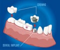 Isometric Professional Prosthetic Stomatology Template