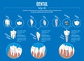 Isometric Prosthetic Dentistry Infographic Concept