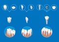 Isometric prosthetic dentistry infographic template with crown veneer