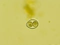 Isospora spp. oocyst from cat feces under the microscope Royalty Free Stock Photo