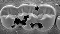 Extreme Close-up Scanning Electron Microscope Image of Severely Decayed Teeth Cavities Keywords: tooth, teeth Royalty Free Stock Photo