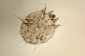 Itch-mite, parasitic microorganism of human skin