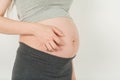Itching in women pregnant Royalty Free Stock Photo