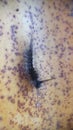 itchy caterpillar hair