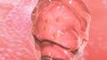 IVF Embryo transfer