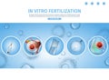 IVF Process Procedures Schematic Explanations.