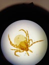 Ixodid tick under a microscope. Royalty Free Stock Photo