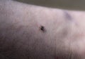 Ixodoidea mite crawls on human skin close up Royalty Free Stock Photo