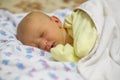 Jaundice in a newborn baby