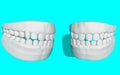 Jaw, cast of teeth, human teeth. Dentistry, periodontist. 3D-rendering
